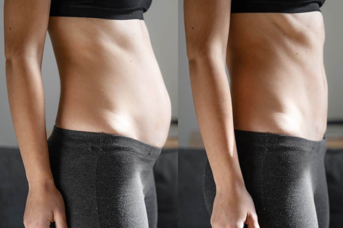 Post-Pregnancy: What Happens to Your Abdominal Muscles After Birth St Albans