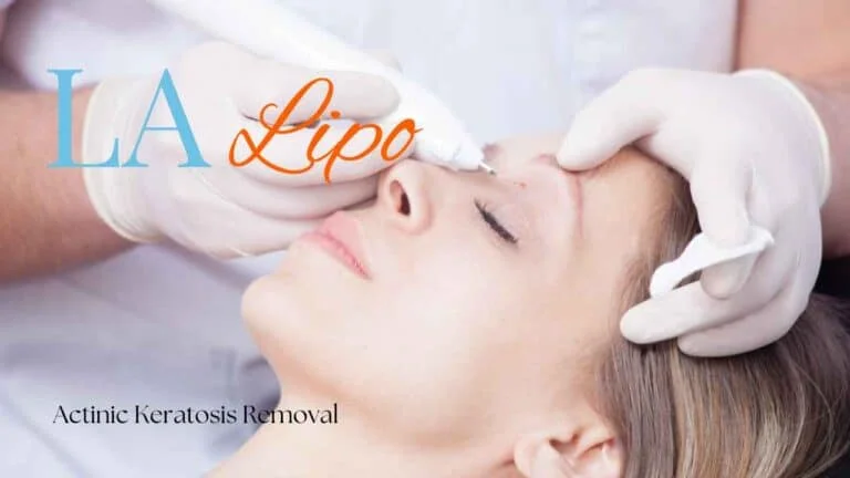 Woman receiving Actinic Keratosis Removal Treatment St Albans