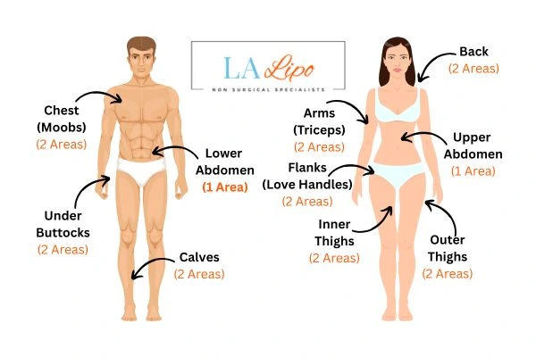 LA LIPO Cryolipolysis Areas St Albans
