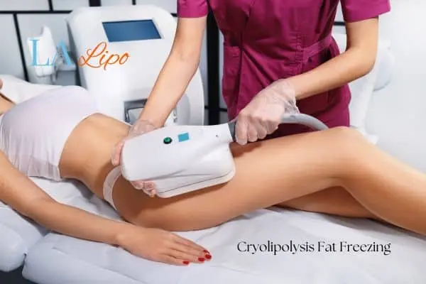 Woman receiving coolsculpting St Albans treatment on her thighs
