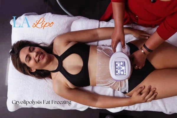 woman getting cryolipolysis St Albans