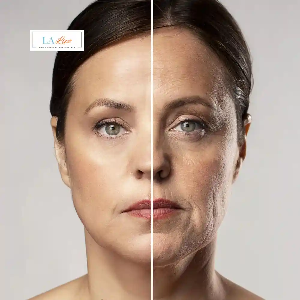 How Can You Tell If Non-Surgical Skin Tightening Is Right for You St Albans?