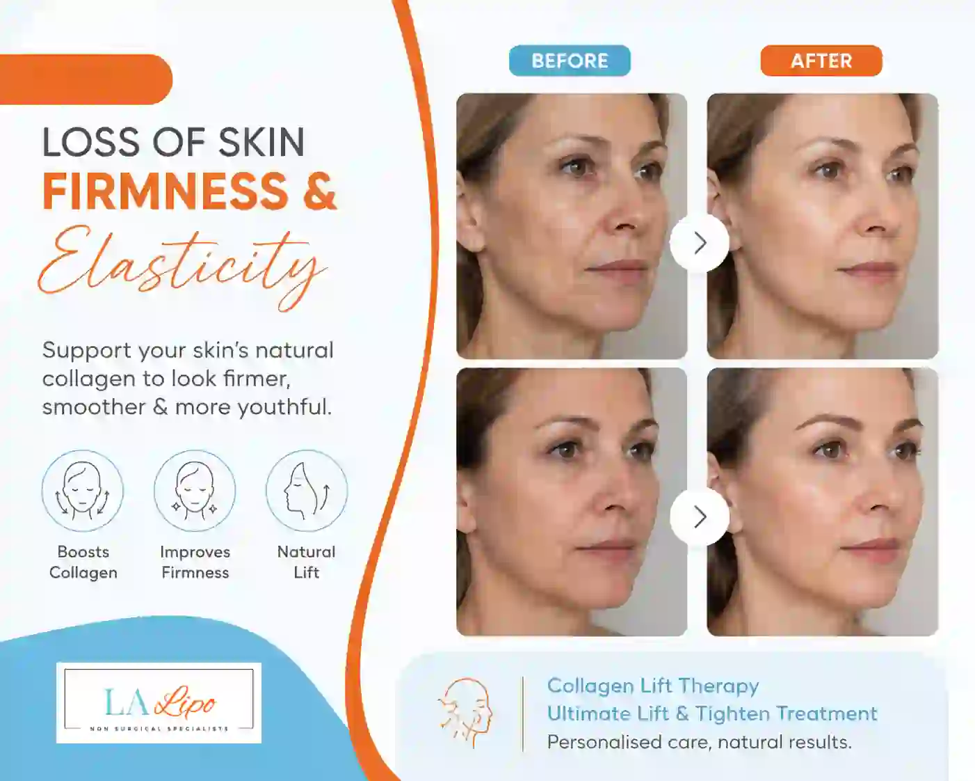 Sign #7: Loss of Skin Firmness and Elasticity St Albans