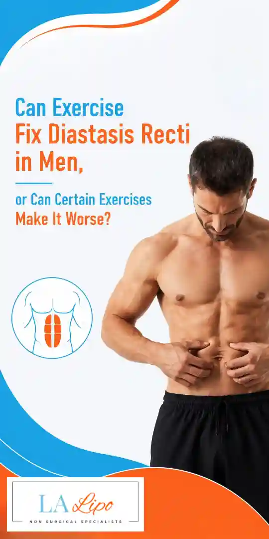 Can Exercise Fix Diastasis Recti in Men, or Can Certain Exercises Make It Worse St Albans?